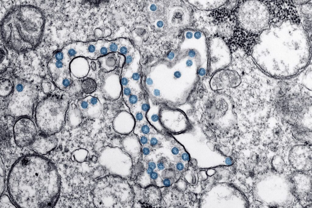 Parasite outbreak puts US health agencies on fruit alert as industry pushes back