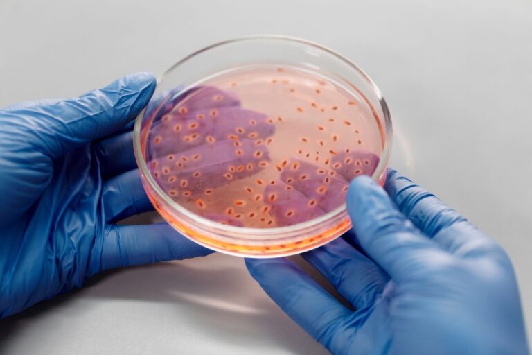Cyclospora outbreak