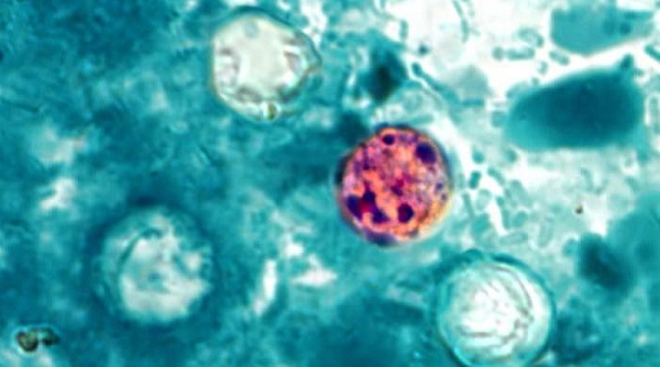 cyclosporiasis